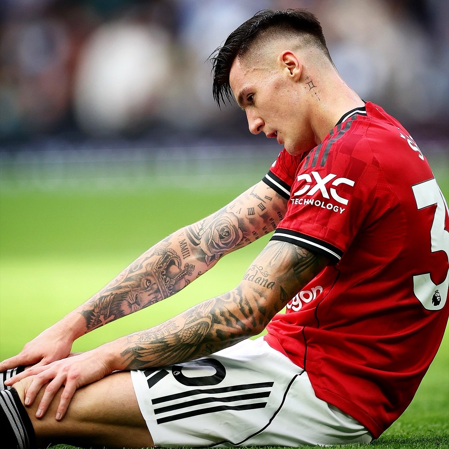 อโมริม รับ ! กังวลเรื่องโรคเดี้ยงของ เซสโก้